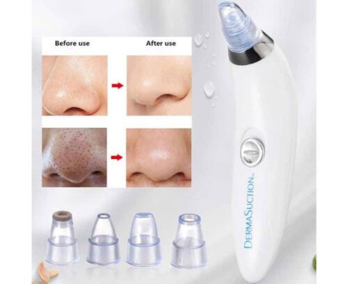 Blackhead Removal Machine-derma Suction 4 In 1 Black Head Remover Machine-acne Pimple Pore Cleaner Vacuum Suction Tool - Image 5