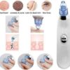 Blackhead Removal Machine-derma Suction 4 In 1 Black Head Remover Machine-acne Pimple Pore Cleaner Vacuum Suction Tool - Image 6