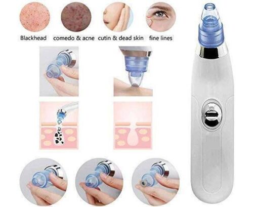 Blackhead Removal Machine-derma Suction 4 In 1 Black Head Remover Machine-acne Pimple Pore Cleaner Vacuum Suction Tool - Image 6